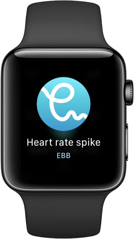 Apple Watch - Short look notification